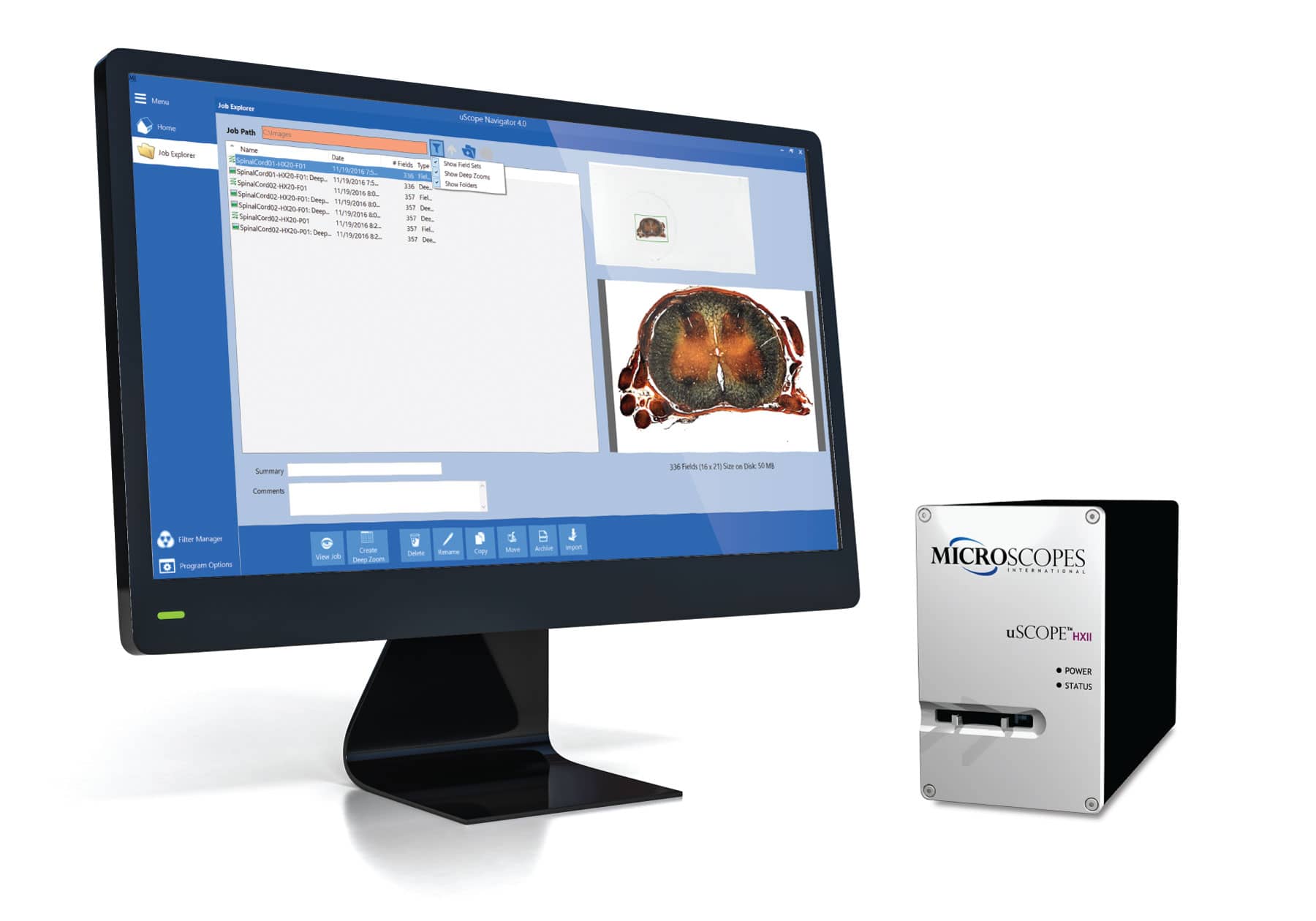 uScopeHXII-10 Whole Slide Scanner