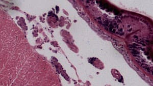 Bilateral Smoothing Filter — Before