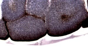 Contrast Filter — After