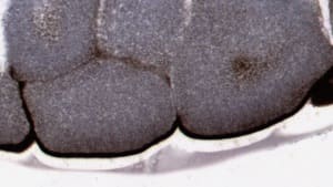 Contrast Filter — Before