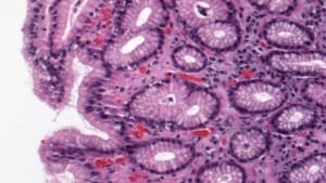 Gamma Filter — Before