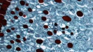 Gaussian Sharpen Filter — Before