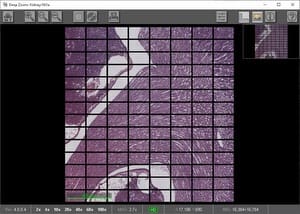 Whole Scan Image with Gaps Between Fields